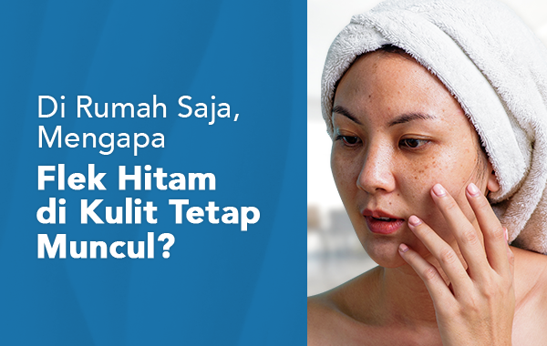 Di Rumah Saja, Mengapa Flek Hitam di Kulit Tetap Muncul?