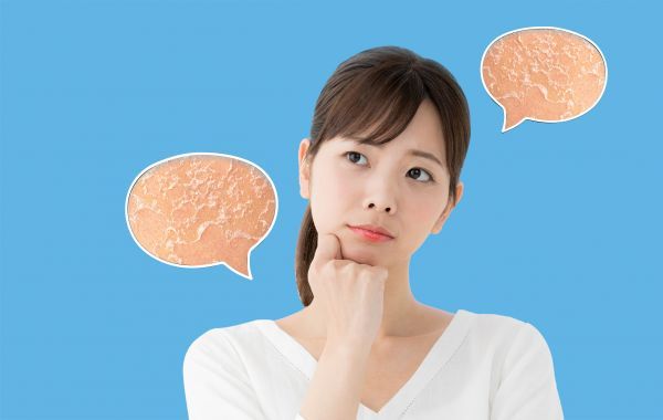 Penyebab Kulit Kering dan Cara Merawatnya